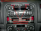 radio removal